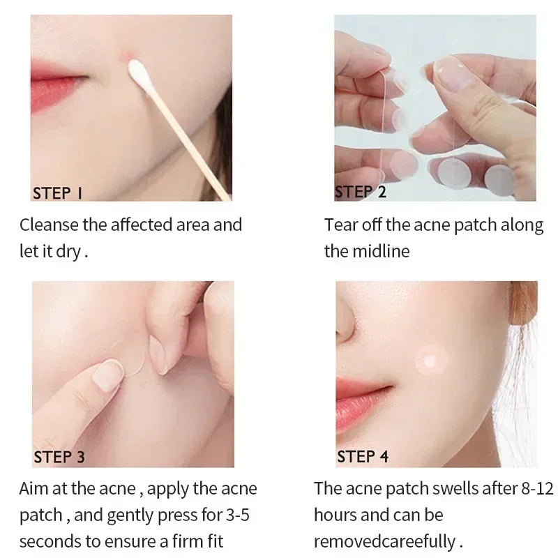72-720 Pcs Invisible Acne Patches – Hydrocolloid Pimple Stickers for Fast Healing, Spot Concealer & Scar Repair, Waterproof & Anti-Blemish Care