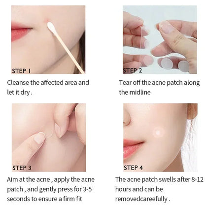 72-720 Pcs Invisible Acne Patches – Hydrocolloid Pimple Stickers for Fast Healing, Spot Concealer & Scar Repair, Waterproof & Anti-Blemish Care